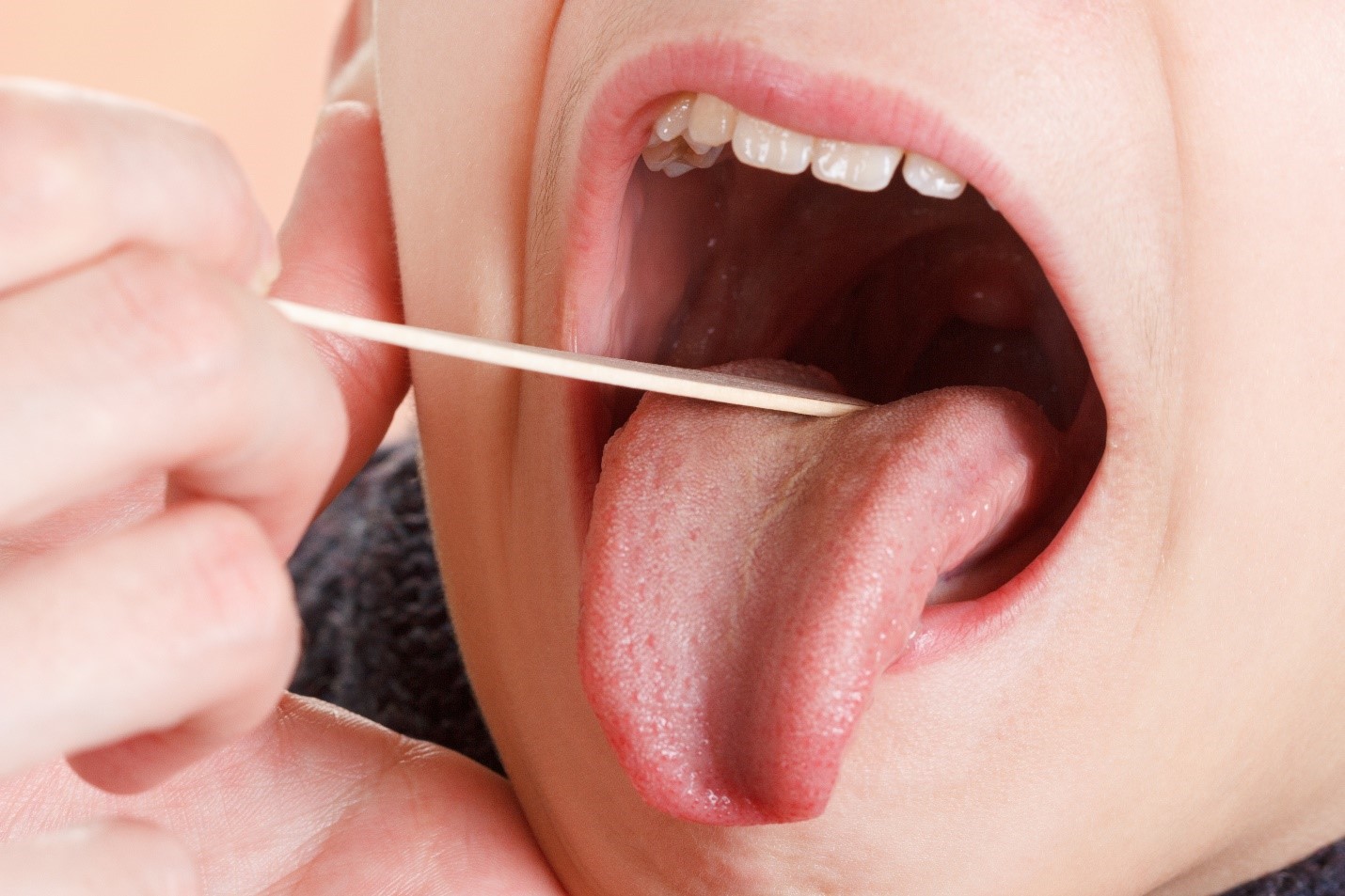 tonsils